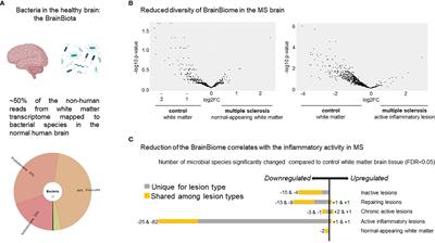 Hypothesis of a potential BrainBiota and its relation to CNS autoimmune inflammation